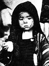 Hiroshima Survivor with Rice Ball